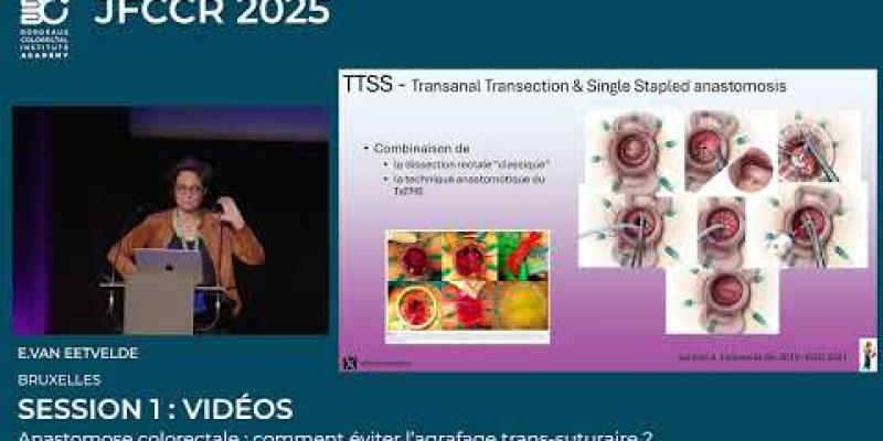 Congres JFCCR 2025_SESSION 1 : SESSION VIDEOS